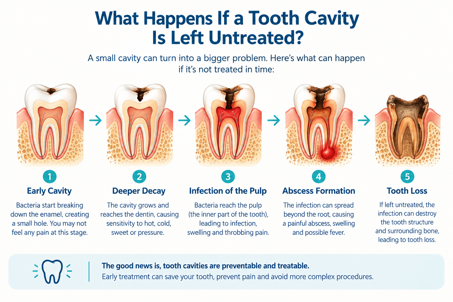 Dentist checking a tooth for cavities
